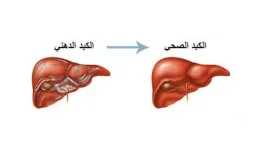 التغذية والدايت