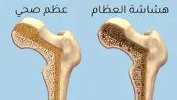 الصحة